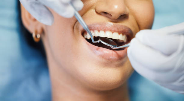 Best Emergency Wisdom Teeth Removal in Pitcairn, PA